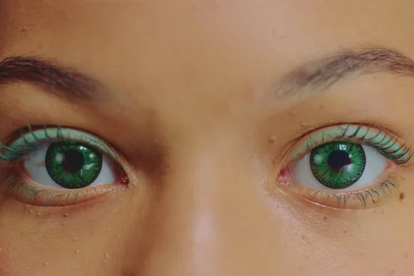 Common Contact Lens Problems Causes, Solutions & Prevention Tips