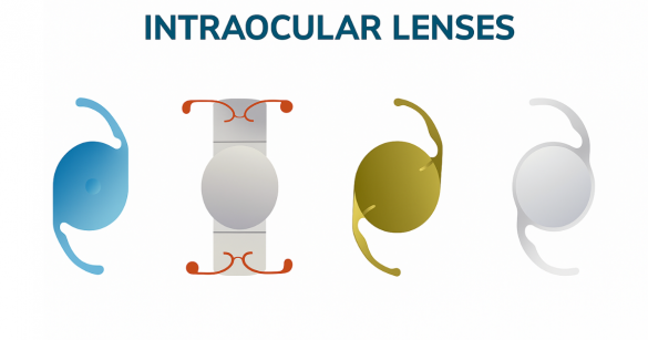 IOL Lenses for Cataracts Patients Ultimate Guide in Dubai 2025