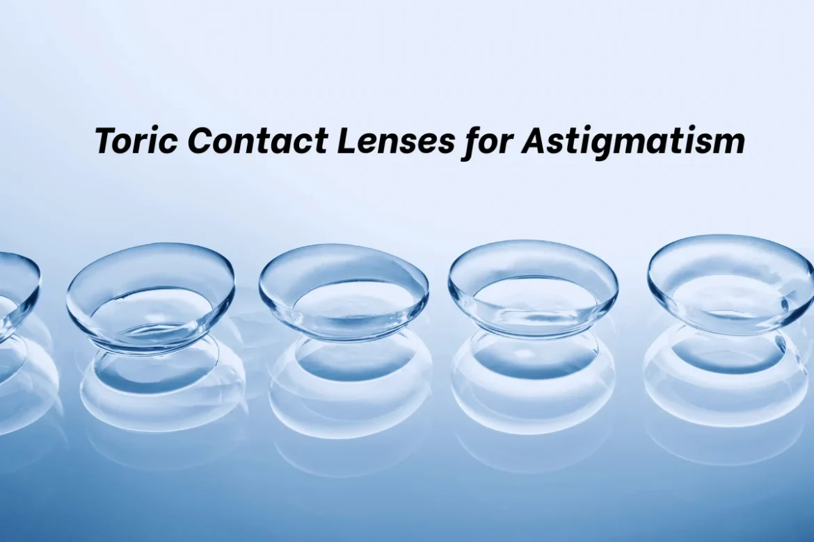 Toric Contact Lenses for Astigmatism